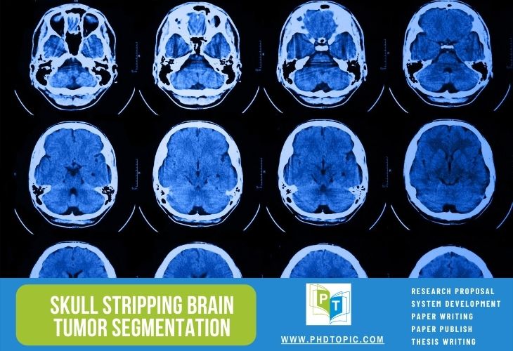 Implementing Skull Stripping Brain Tumor segmentation research projects